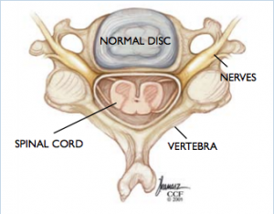 Normal Cervical Disc