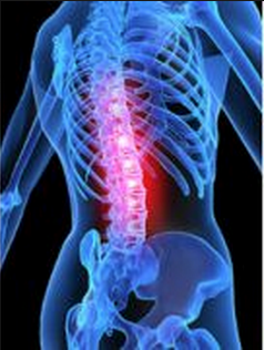 Spine_Infection_2